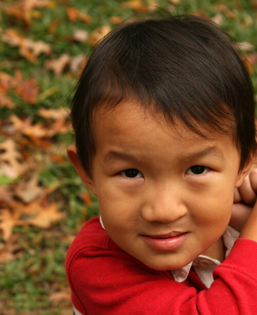 Cute Chinese little boy with cleft palate