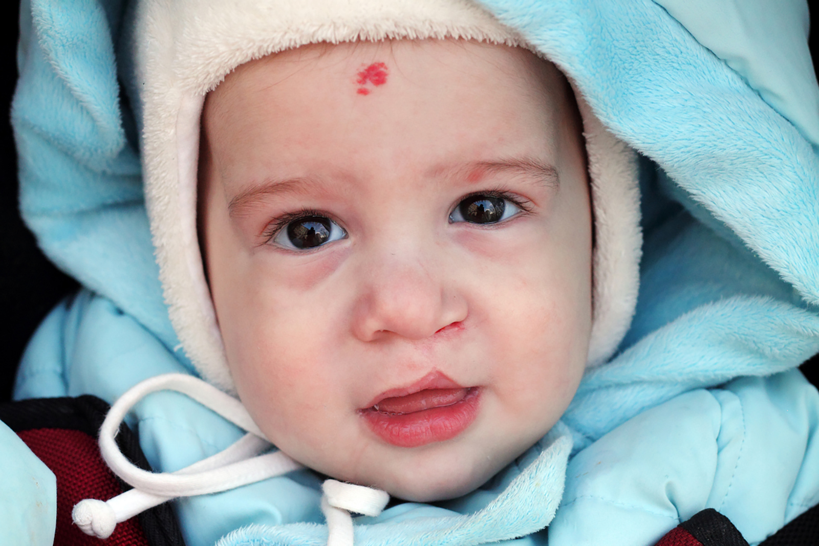Baby in winter Baby with Cleft lip